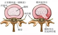 <b>如何拯救老司机的腰椎？</b>