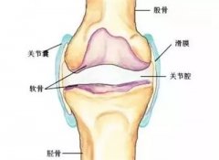 <b>膝盖又肿了？滑膜炎是不是真的只休息就够了</b>