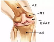 <b>一动就疼！膝关节骨性关节炎患者到底还能运动</b>